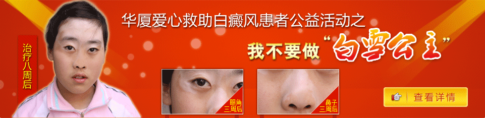 华厦爱心救助白癜风患者公益活动之我不做“白雪公主”