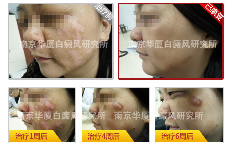 十大康复案例之七 ——拿什么来拯救你,我的母亲?女孩寻医六载 终让母亲再次绽放笑颜